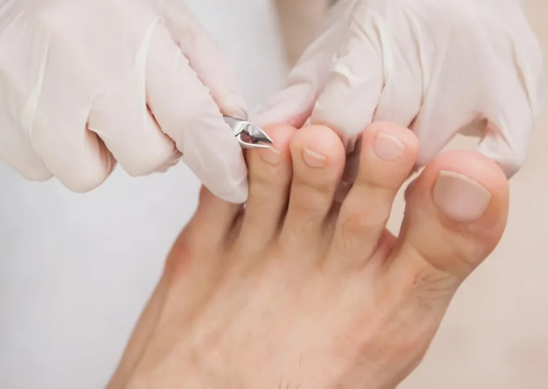 Pedicurebehandeling van de voeten